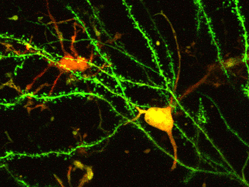 fluorescence-3 Eine kurze Einführung in die Super-Resolution-Mikroskopie