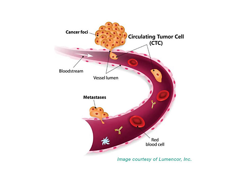 Nachweis von zirkulierenden Tumorzellen mit der SPECTRA Lichtquelle von Lumencor